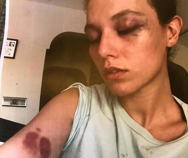 Ozan Güven ve Deniz Bulutsuzun davasında karar çıktı Aldığı ceza belli oldu