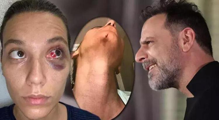 Ozan Güven ve Deniz Bulutsuzun davasında karar çıktı Aldığı ceza belli oldu