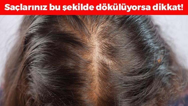 Saçların avuç avuç dökülmesini engelliyor Sirkeyle karıştırıp sürünce saç köklerine vitamin yükleyip anında ışıl ışıl parlatıyor