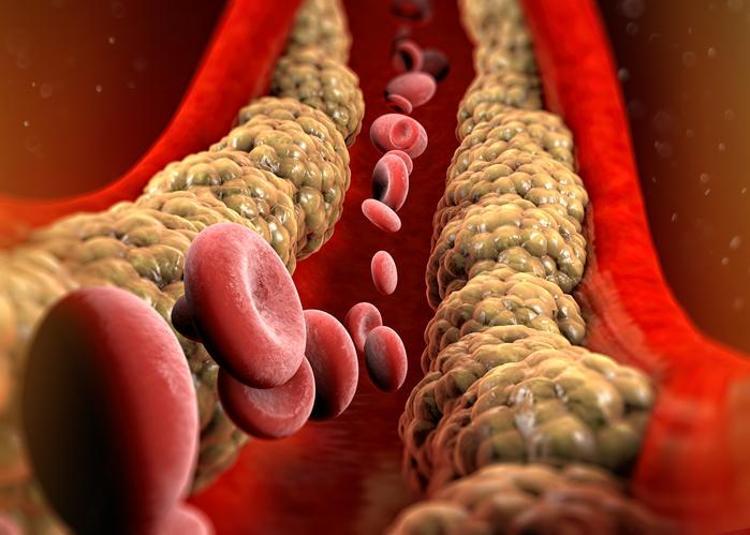 Kolesterol seviyelerini sıfırlamanın sırrı Haftada 150 dakika yapın: Damarları açıp erken yaşlanmayı önlüyor