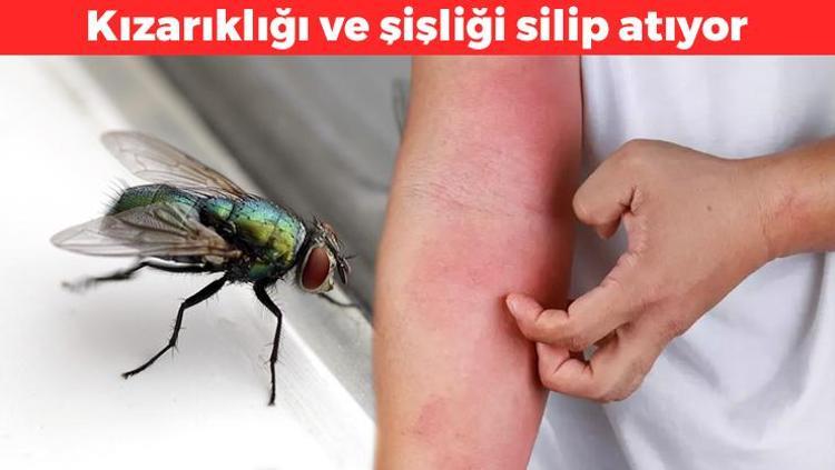 Sivrisinek ısırığından koruyan yöntem Kaşıntısının doğal çözümü: Kızarıklığı ve şişliği silip atıyor
