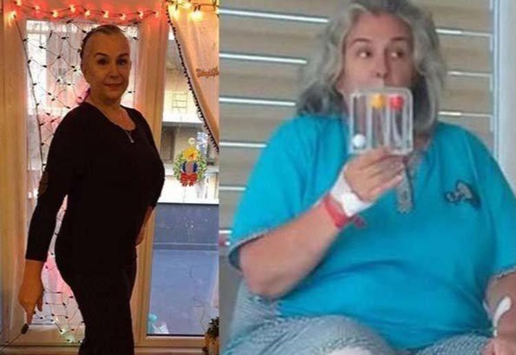 Bambi lakaplı Burçin Orhon’dan yıllar sonra gelen Alzheimer itirafı