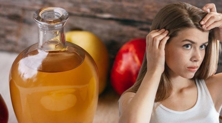 Egzama, kepek, kaşıntıyı kökten kazıyor Saç derisindeki kuruluğun çözümü: Banyoda 1 damla sürmek etkisini 2ye katlıyor
