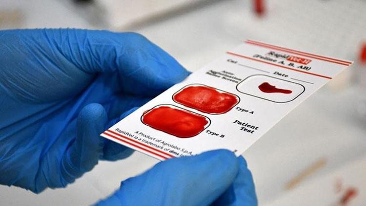 Yeni kan grubu keşfedildi Dünyada sadece 1 kişide bulunuyor: 68 yaşındaki kadında tespit edildi