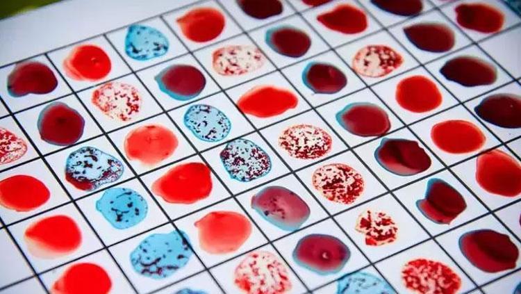 DNA ANALİZİNDEN ÇIKAN ŞAŞIRTICI SONUÇ