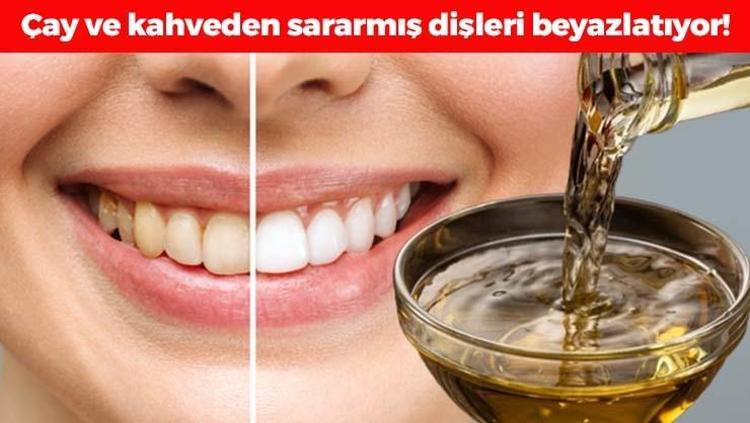 İnci gibi dişlerin sırrı Çay ve kahveden sararmış dişleri anında beyazlatıyor: Ağız içerisinde plak ve bakterileri de yok edip gülüşünüzü ışıl ışıl yapıyor