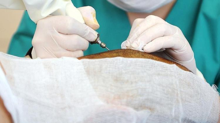 TANSİYON, ANEMİ, ŞEKER GİBİ KRONİK RAHATSIZLIKLAR GÖZLEMLENMELİ