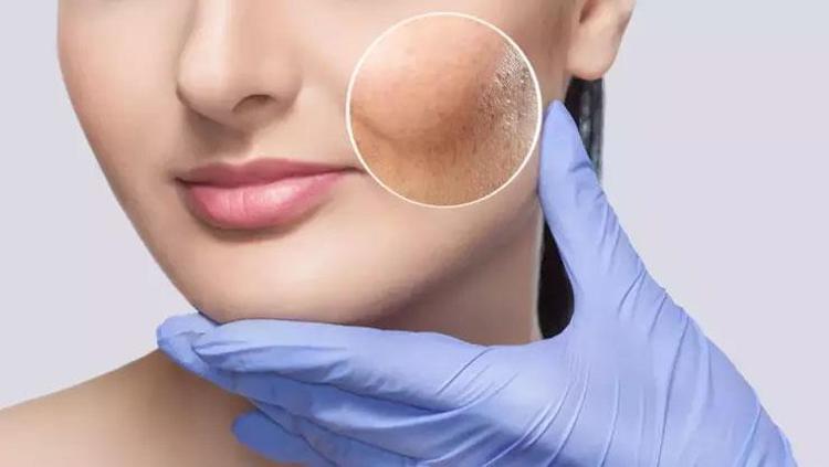 10 dakikada bebek gibi bir cilt Doğal yöntemler arasında en iyisi: Kırışıklıkları silgi gibi siliyor