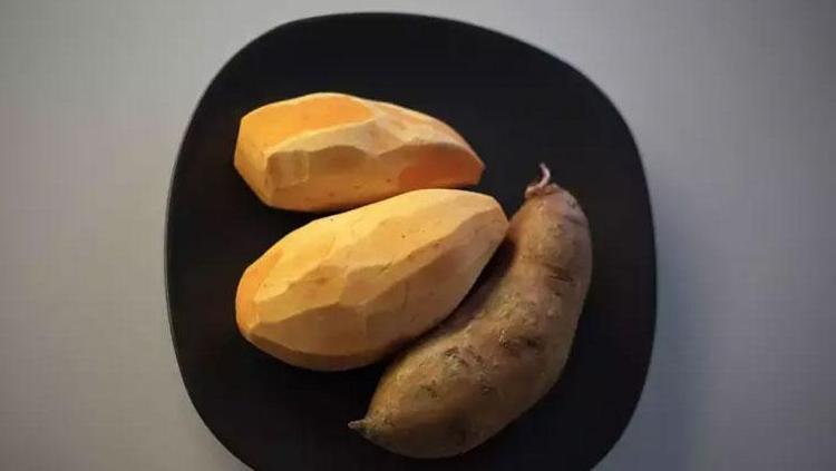 GÖZ SAĞLIĞINI KORUYOR