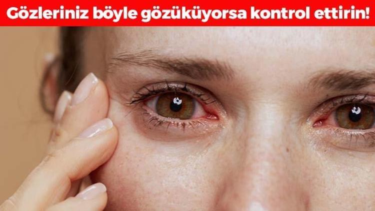 Gözyaşının da kalitesi varmış Bu sebeplere bağlı olarak bozuluyor, yanma ve batma varsa aman dikkat