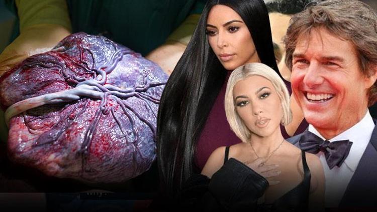 Kardashianlar, Tom Cruise, Blac Chyna... Doğal diye moda olmuştu ama tehlike saçıyor Uzmanlar uyardı: Zararları çok büyük