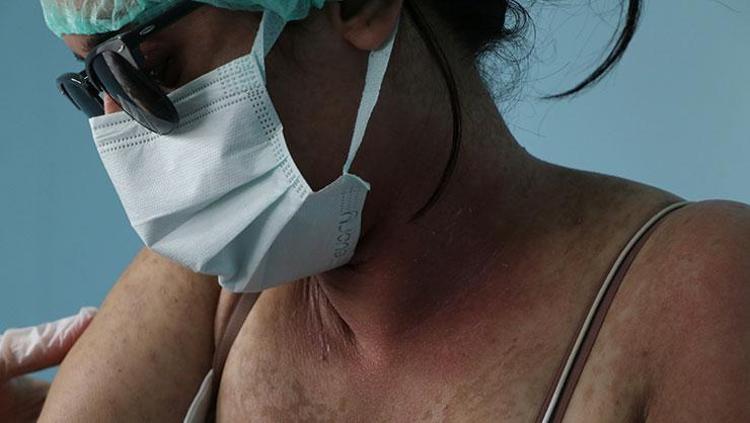 İnternetten satın aldı, hastanelik oldu Uzman isim uyardı: Kezzap gibi bir ürün