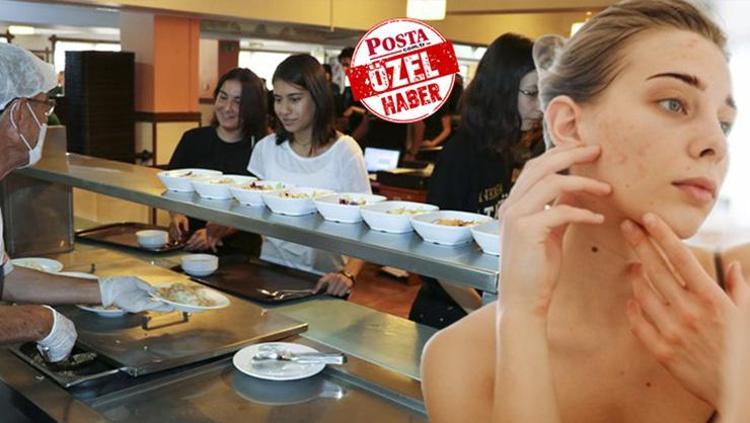 Akne tedavisi için kremlere para vermeden önce bir daha düşünün Sivilceleriniz nedeni yediğiniz besinler olabilir