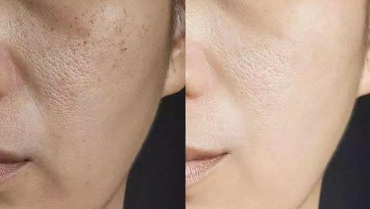 Cildi 1 gecede duvar gibi yapıyor Ölü hücreleri kazıyıp atıyor: Neme doyuruyor