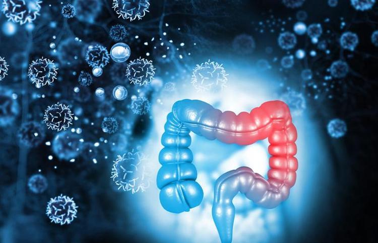 Haşlayıp kaşık kaşık yiyince kolon kanseri riskini yüzde 20 düşürüyor Bağırsakları harıl harıl çalıştırıp vücuttaki iltihabı kurutuyor