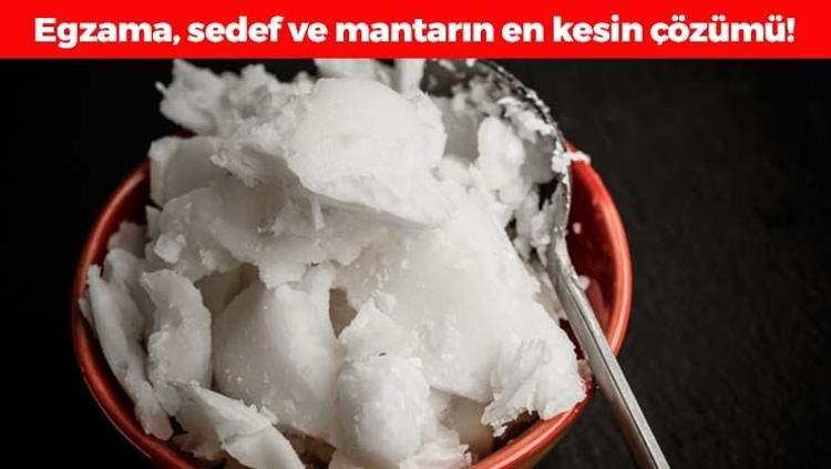 Egzama, mantar ve sedefin kökünü kazıyor Bir kaşığı eritip sürmek yetiyor: Cildi ışıl ışıl parlatıp anında gençleştiriyor