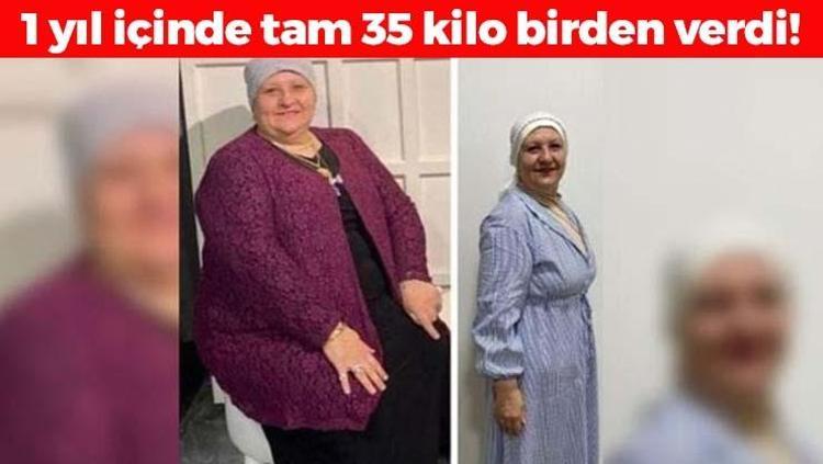 54 yaşındaki kadın tam 35 kilo verdi 119 kilodan 84e düştü: Yağları cayır cayır eritiyor, meğer mum gibi erimenin sırrı buymuş
