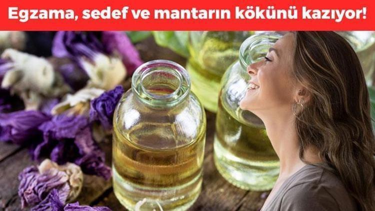 Egzama, sedef ve mantarın kökünü kazıyor Ciltteki yaraları iyileştiriyor, sebum dengesi sağlıyor Tek gecede 10 yaş gençleştiren bakım