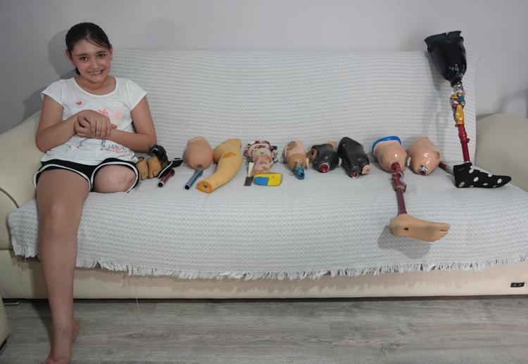 Özgenin büyük heyecanı Protez bacağı için ölçüleri alındı, okula gitmek için gün sayıyor