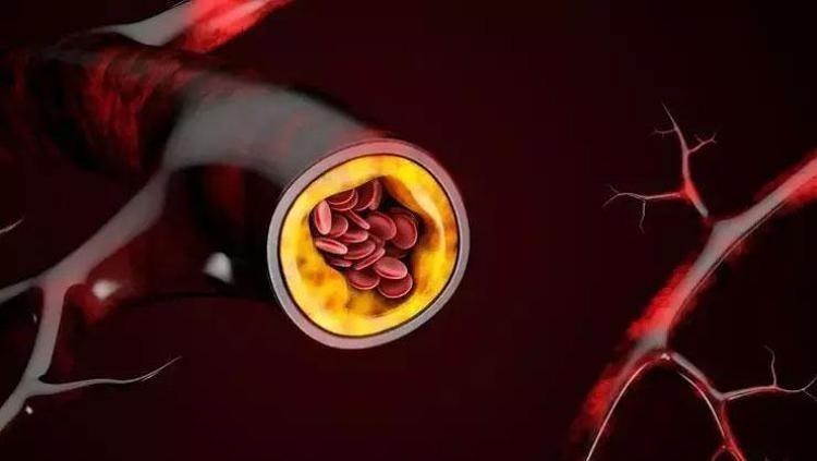 Damarlara stent etkisi veriyor Kalbin meyvesi olarak da biliniyor: Damarları hortum gibi açıyor, plakları silip süpürüyor