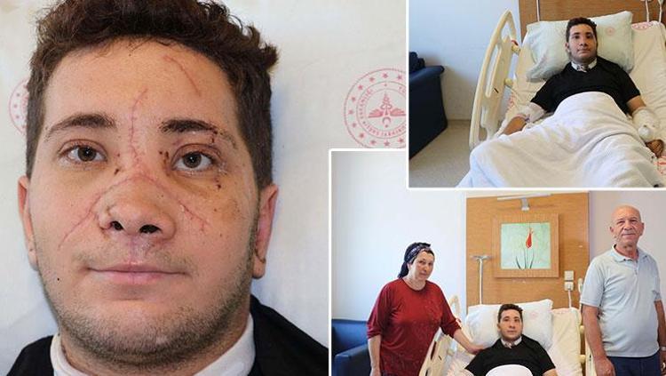 Ölüm riski yüzde 90dı Damarları birbirine dikildi: Adeta hayata tutundu