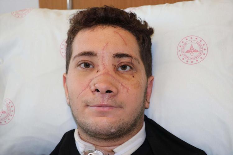 Ölüm riski yüzde 90dı Damarları birbirine dikildi: Adeta hayata tutundu