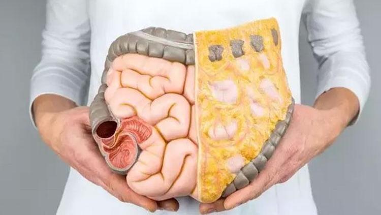 Potasyum ihtiyacının yüzde 12sini karşılıyor Bağırsakları pamuk gibi yumuşatıyor