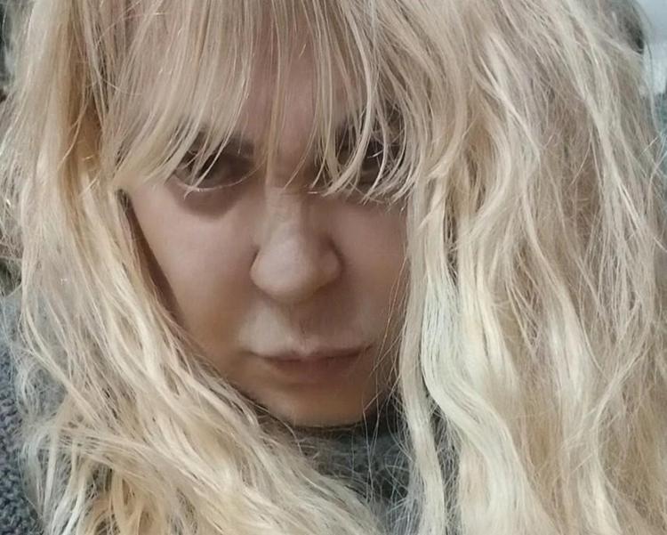 RAHATSIZLIKTAN DOLAYI AĞZIM YAMULDU