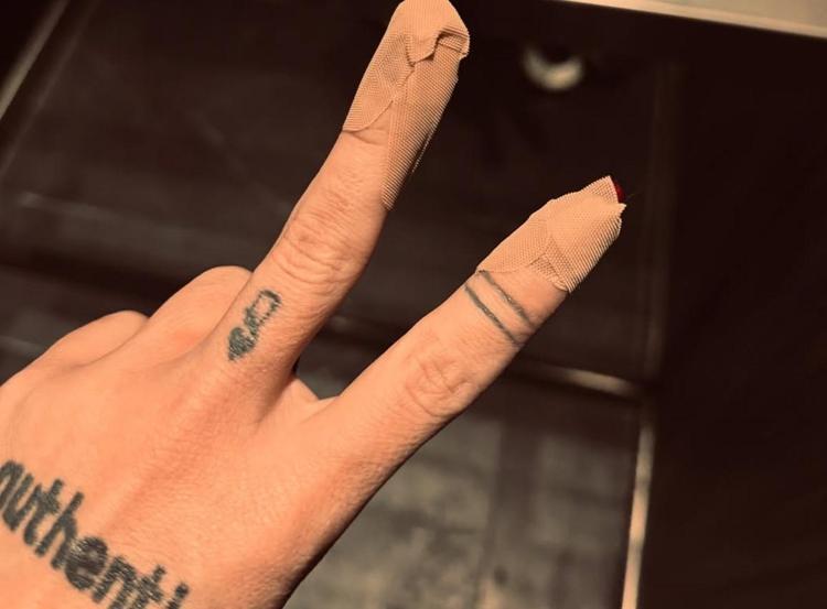 ARBEDEDE TIRNAKLARIM DİPTEN KIRILDI