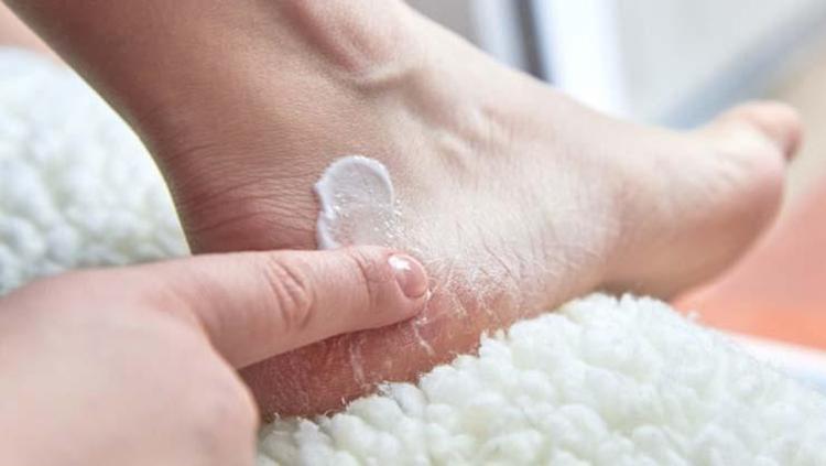Topuk çatlaklarını anında geçiriyor Ayakları bebek gibi yumuşatıyor, 5 dakikada etki ediyor