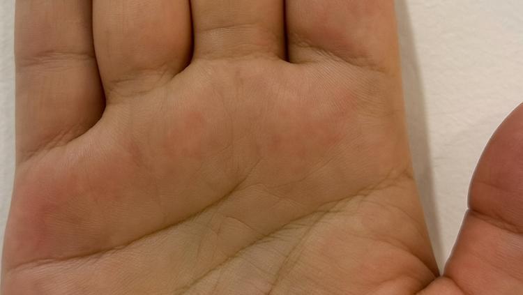 Zenginlik ve başarıyla ilişkilendirilen üç avuç içi işareti: Fizyonomiye göre bu çizgiler nadir görülüyor