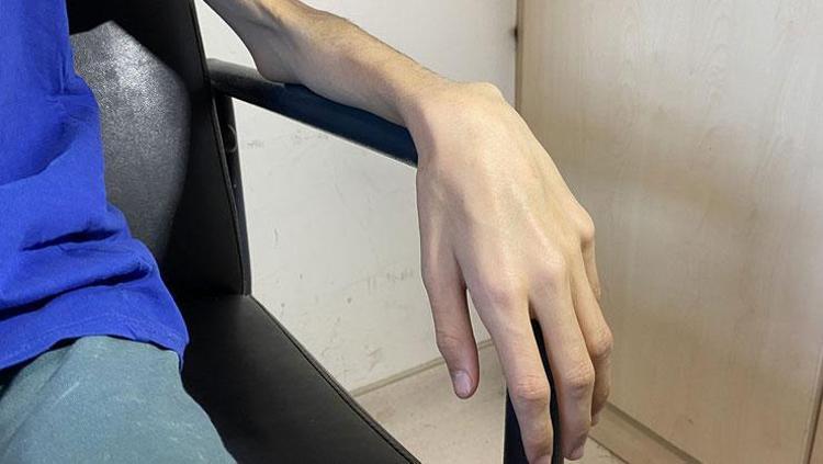 Anoreksiya teşhisi konmuştu ama gerçek başka çıktı 12 yaşında başlayan hayat mücadelesi