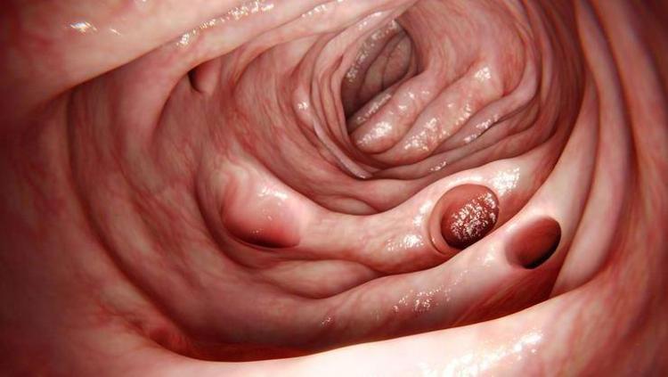 Anoreksiya teşhisi konmuştu ama gerçek başka çıktı 12 yaşında başlayan hayat mücadelesi