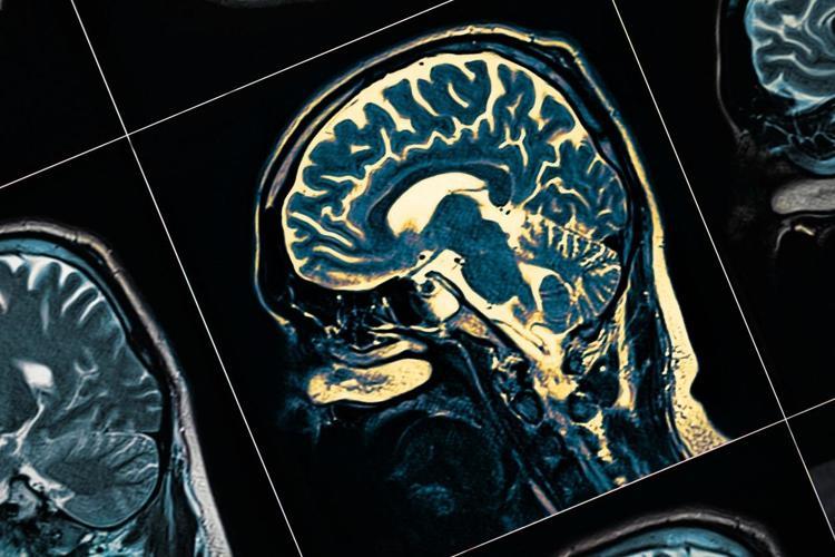 Herkes yaşlandığını düşünüyor ama sinsi bir hastalığın habercisi Uzman doktorlar uyarıyor
