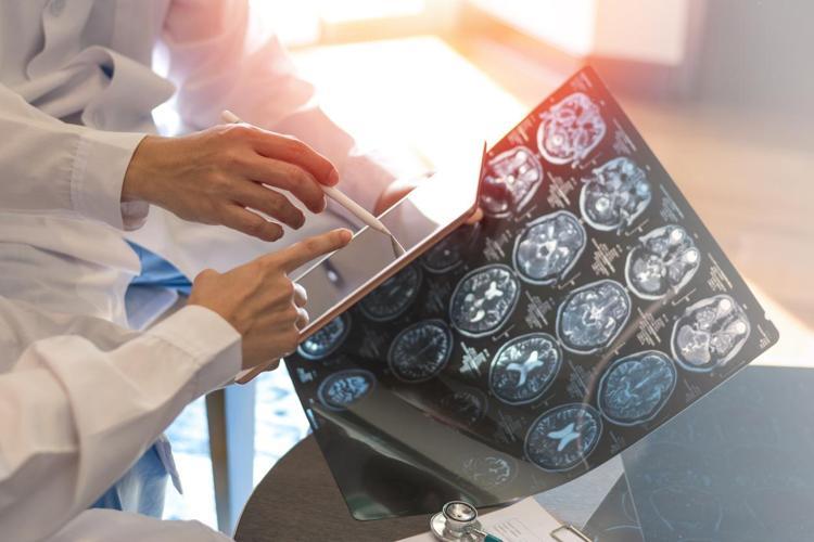 Herkes yaşlandığını düşünüyor ama sinsi bir hastalığın habercisi Uzman doktorlar uyarıyor