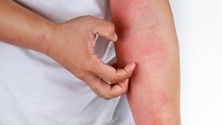 3 YIL SÜREN UYUZ VAKALARI DUYUYORUZ