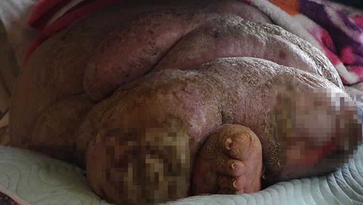 300 kiloluk fil hastasının yardım çığlığı Bu hastalık benimle mezara gitmesin