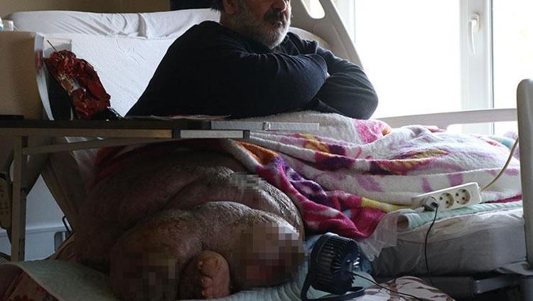 300 kiloluk fil hastasının yardım çığlığı Bu hastalık benimle mezara gitmesin