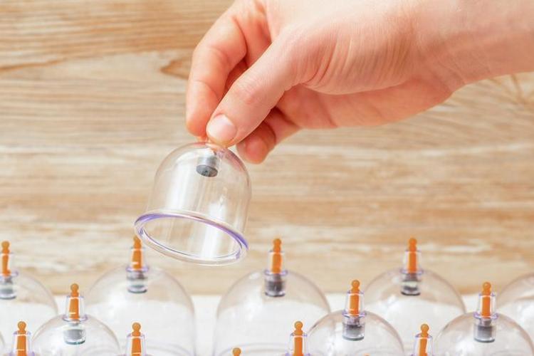 Ocak ayı hacamat günleri nelerdir 2026 Hacamat tarihleri, altın günler ne zaman Ocak ayı hacamat tarihleri