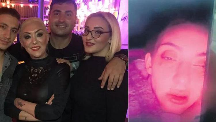 SEVGİLİSİNE DARP EDİLMİŞ HALDEKİ GÖRÜNTÜSÜNÜ YOLLAMIŞ