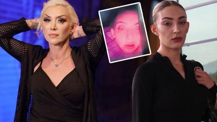 Güllünün kızının darp edilmiş halde görüntüleri çıktı Annem yaptı, gebersinler