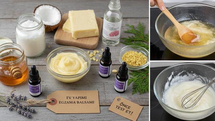 Pul pul dökülmeyi ve kaşıntıyı engelliyor Evde kolayca hazırlanan egzama balsamı tarifi