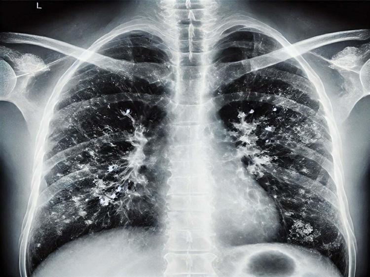 HER İNSAN FARKINDA OLMADAN BİR GÜNDE 20-30 KEZ ELİNİ YÜZÜNE GÖTÜRÜYOR