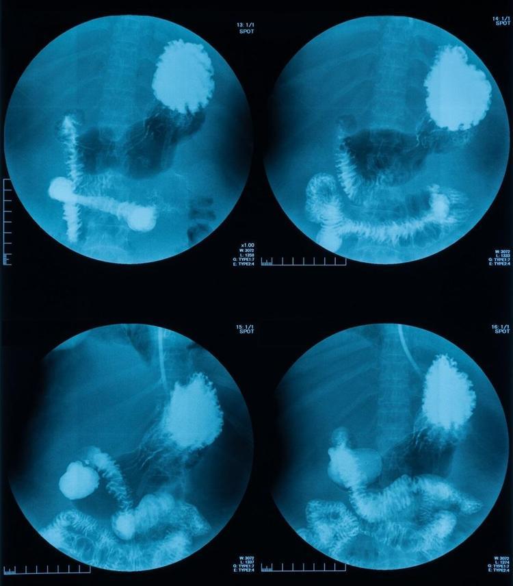 İnsan beyni 18de değil 32 yaşında olgunlaşıyor Bilimsel araştırmalarla kanıtlandı