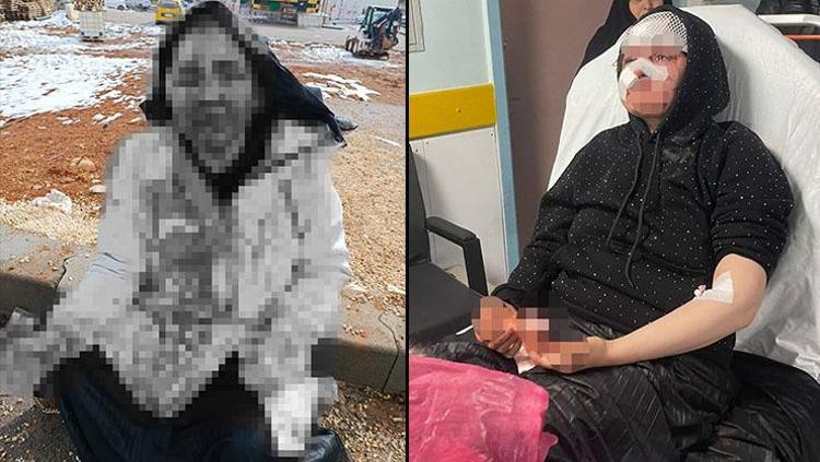 Boşanmak istemeyen kocadan dehşet İfadeni geri çek deyip kaldırım taşıyla dövdü