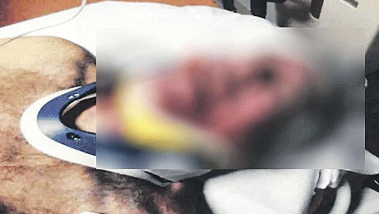 Epstein belgeleri adeta dipsiz bir kuyu Korkunç detaylar ortaya saçıldı