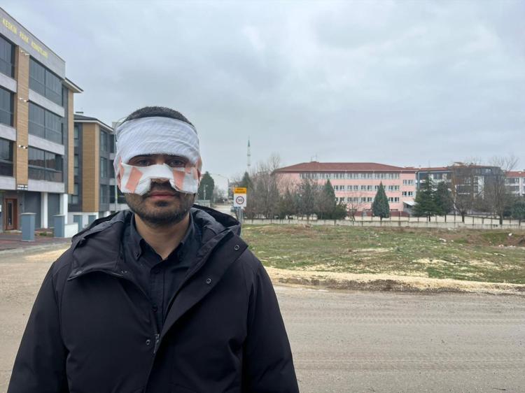 BANA YARDIM EDİN, BENİM YÜZÜM YANDI