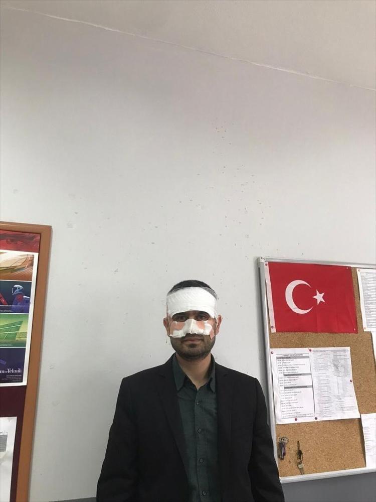 YANIMA YAKLAŞARAK OMUZ ATTI
