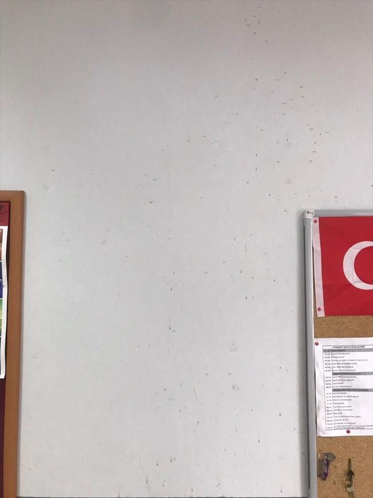 SICAK ÇAYI YÜZÜME FIRLATTI