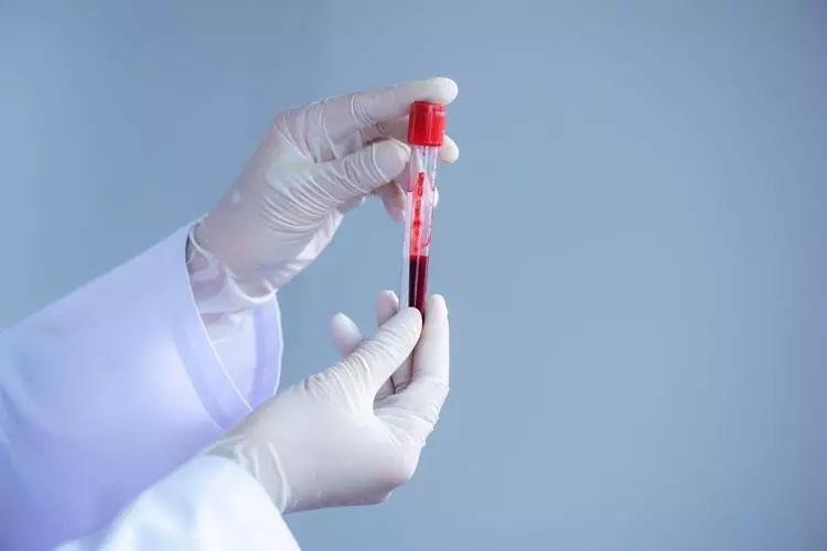 0 GRUBU KALP HASTALIKLARINA KARŞI BİR ADIM ÖNDE